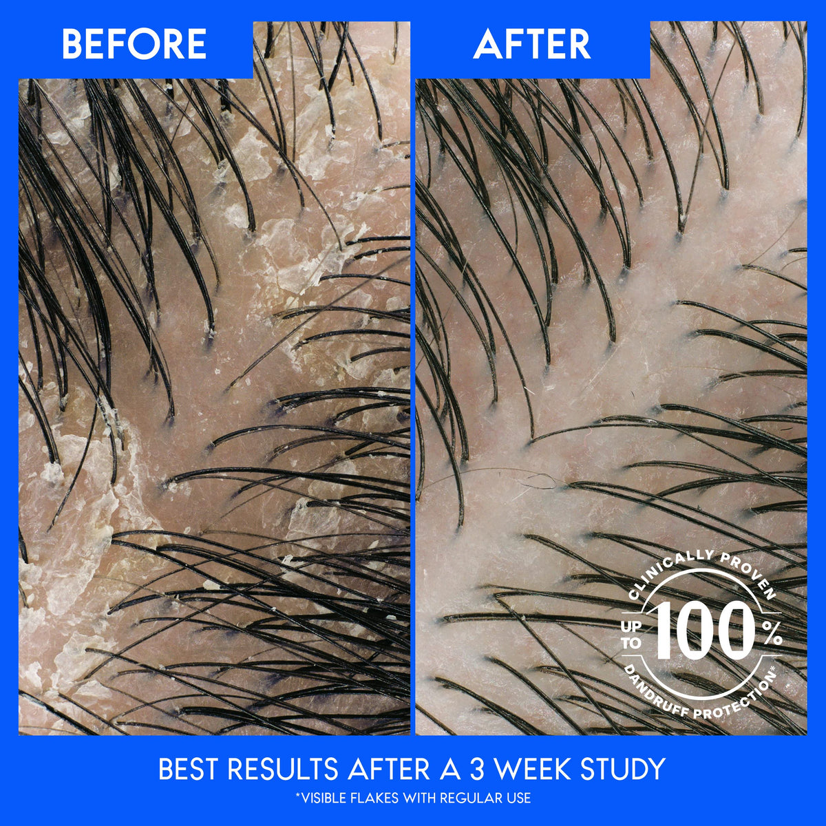 head & shoulders conditioner foam applied to hair showing gentle hydration benefit