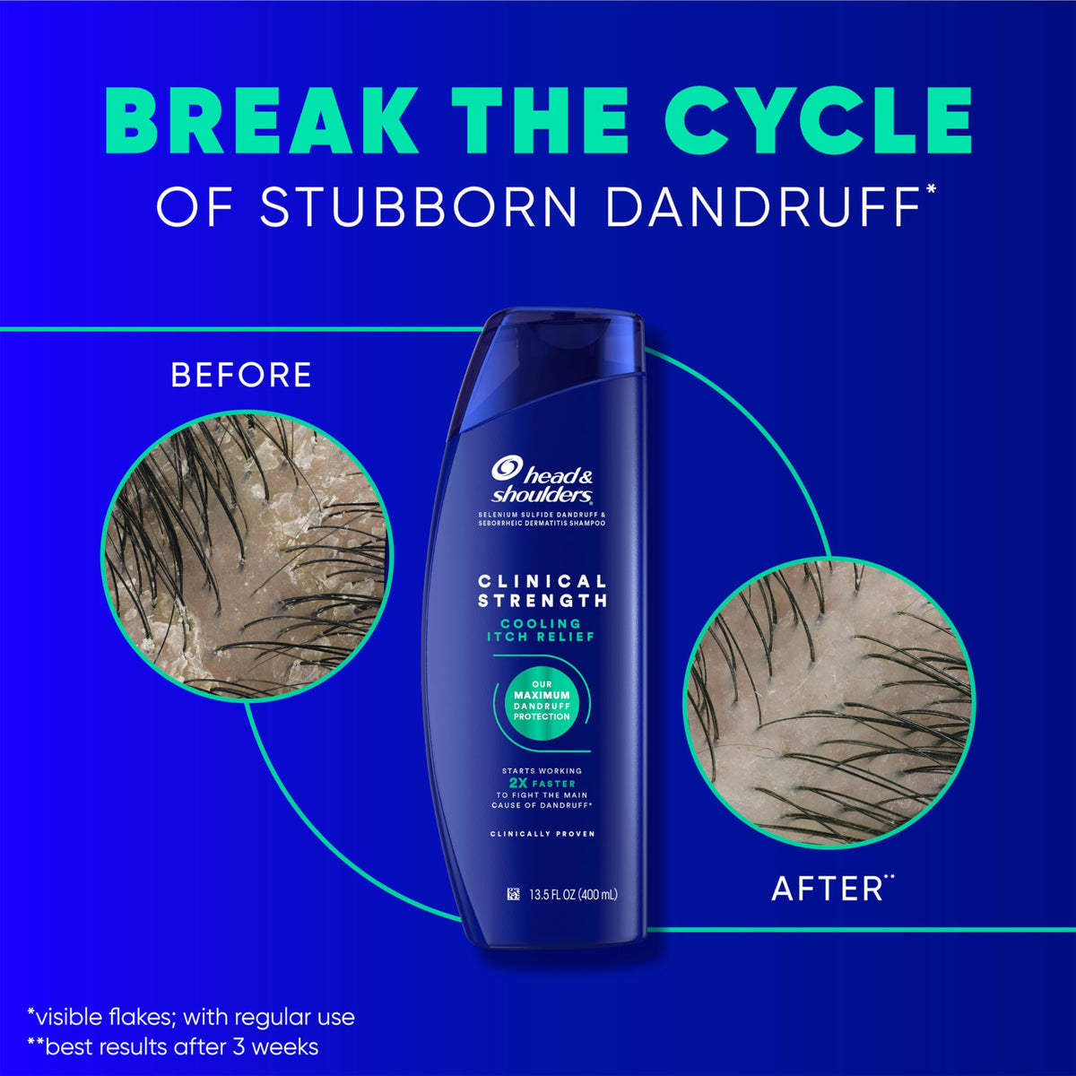 Head & Shoulders label showing 1% selenium sulfide active ingredient information