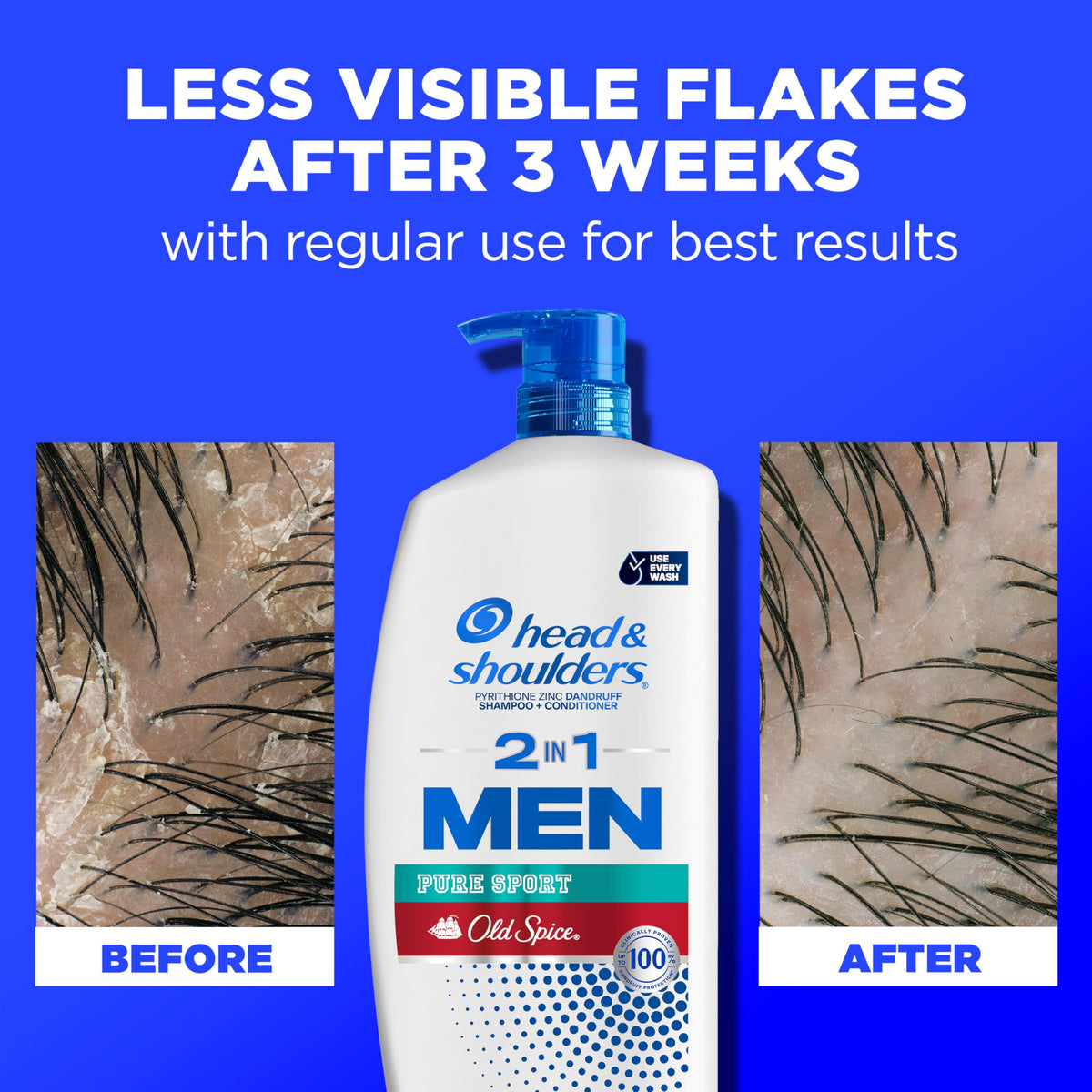 Head & Shoulders bottle in hand to show scale and long-lasting supply benefit