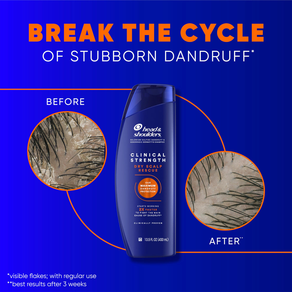 Application to scalp demonstrating Head & Shoulders helps target flakes and soothe irritation