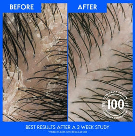 Head & Shoulders fit in a gym bag illustrating travel-ready benefit
