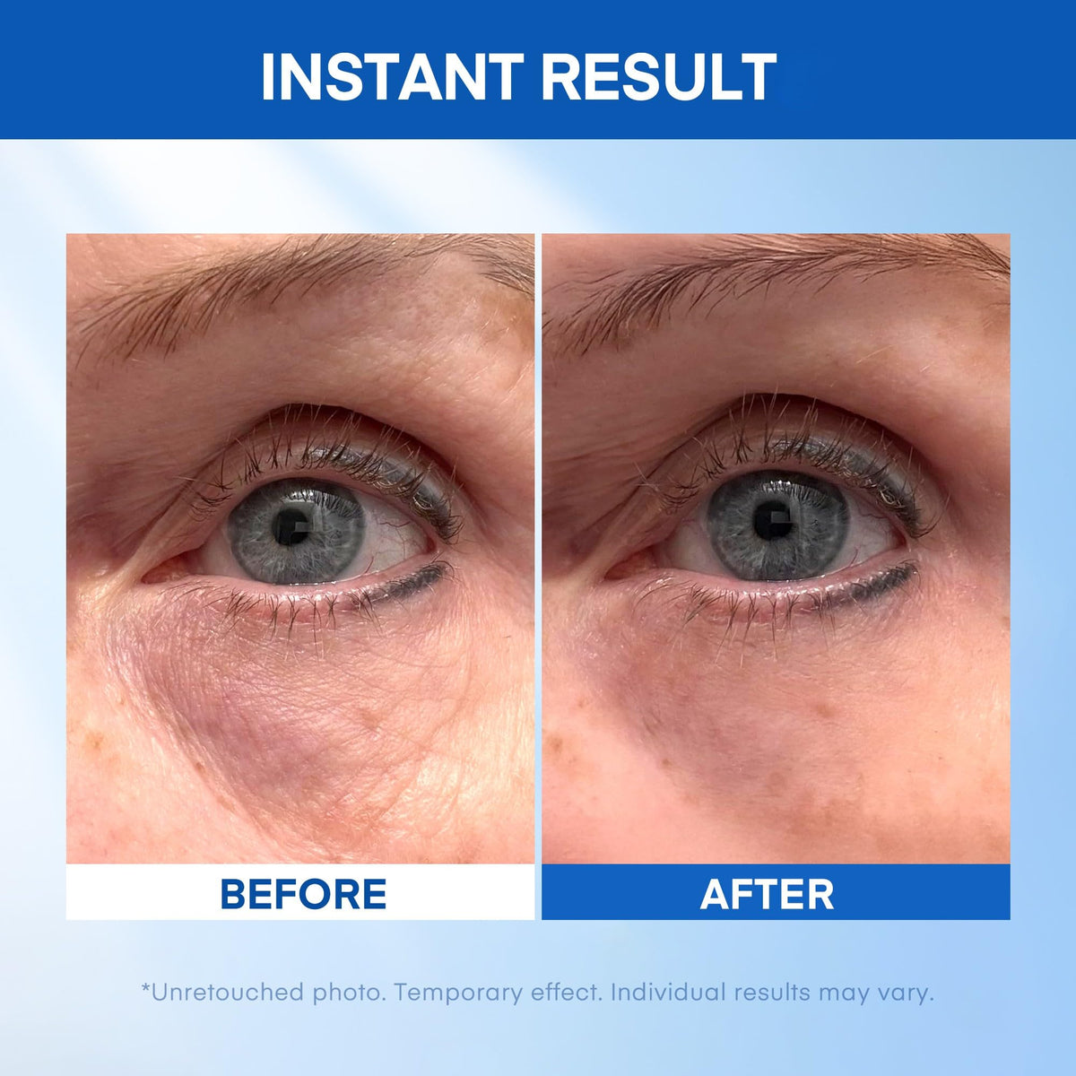 HealthyDerm before and after comparison showing reduced puffiness and wrinkles