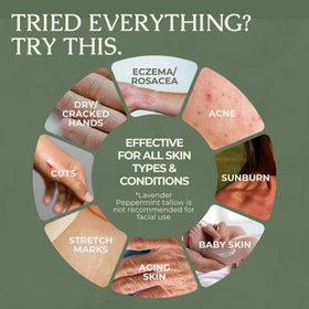 Hearth and Homestead applying balm to hands highlighting instant hydration benefit
