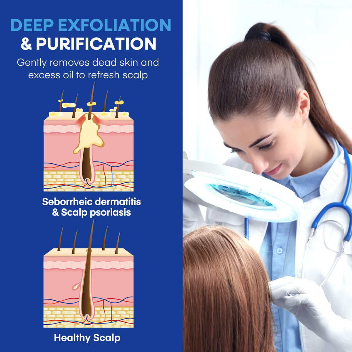 Hermon shampoo in use with scalp massage to reduce itch and flakes