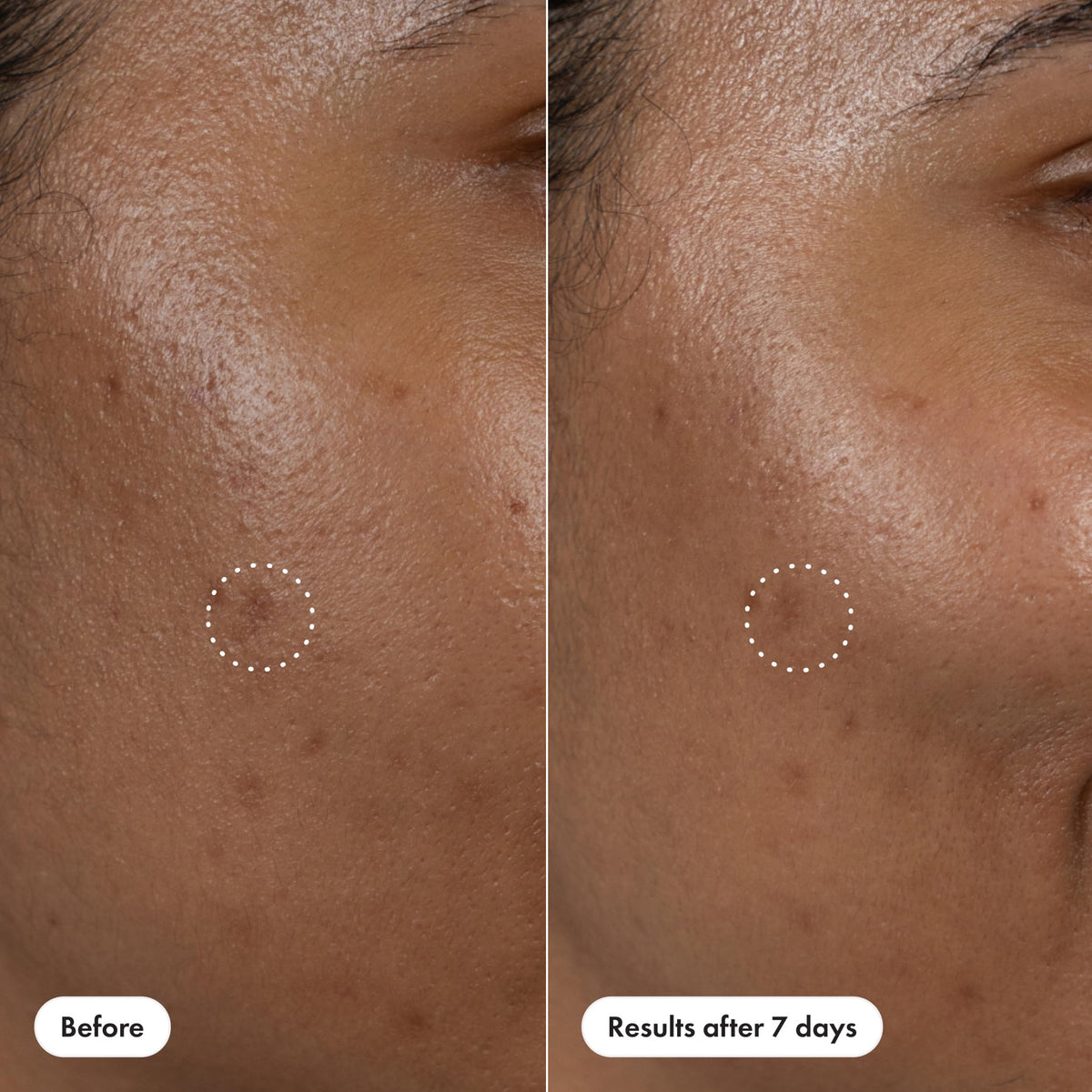 HERO COSMETICS serum used outdoors for on-the-go targeted treatment benefit