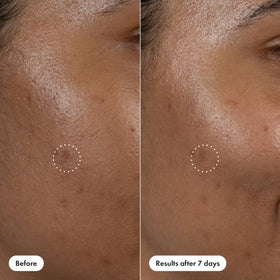 HERO COSMETICS serum used outdoors for on-the-go targeted treatment benefit