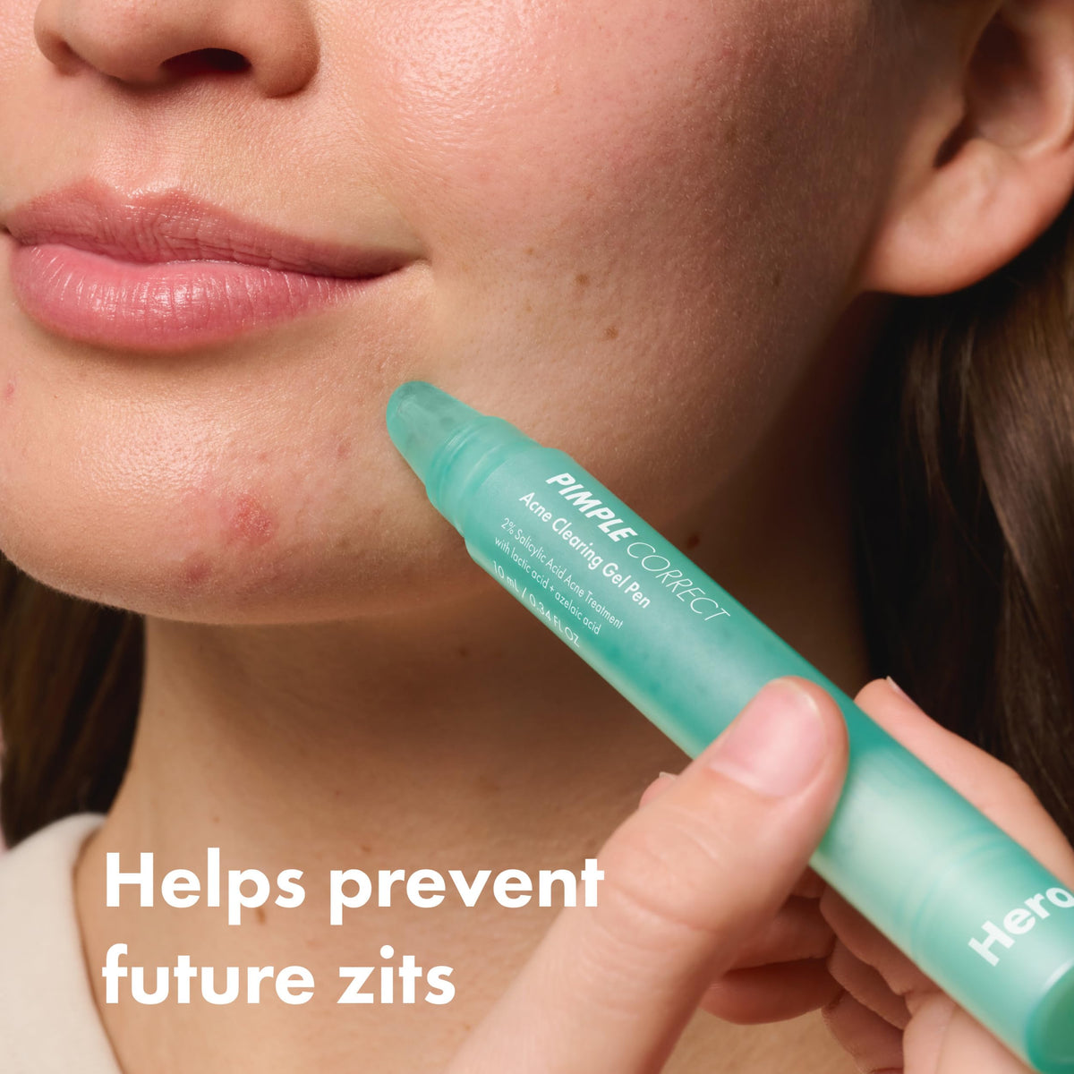 HERO COSMETICS applying gel to a single blemish demonstrating targeted use