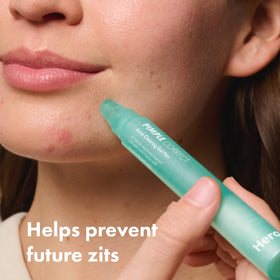 HERO COSMETICS applying gel to a single blemish demonstrating targeted use