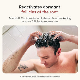 hims product applied to scalp targeting thinning areas effectively