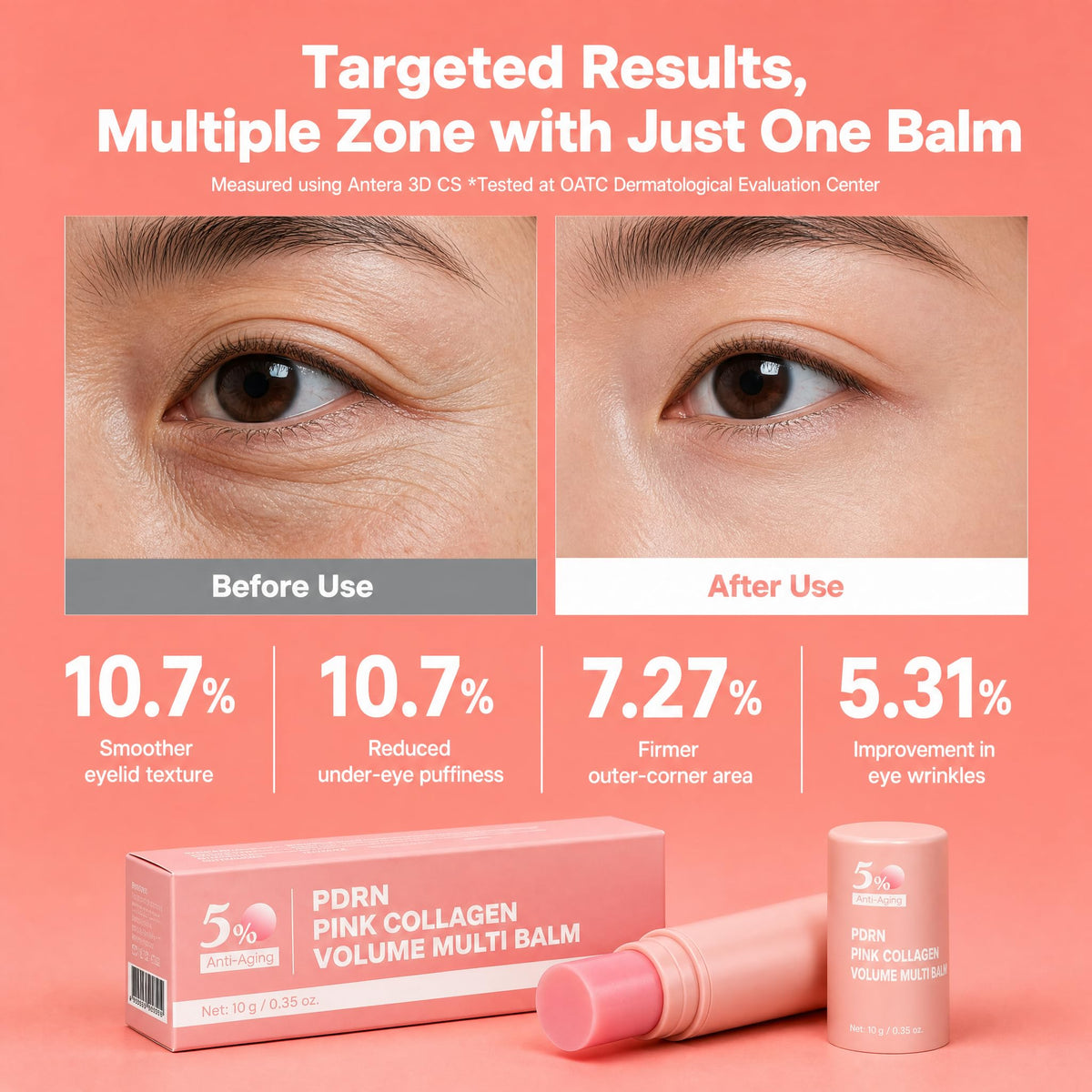 HLion ERA being applied under-eye demonstrating precise targeting and depuffing benefit