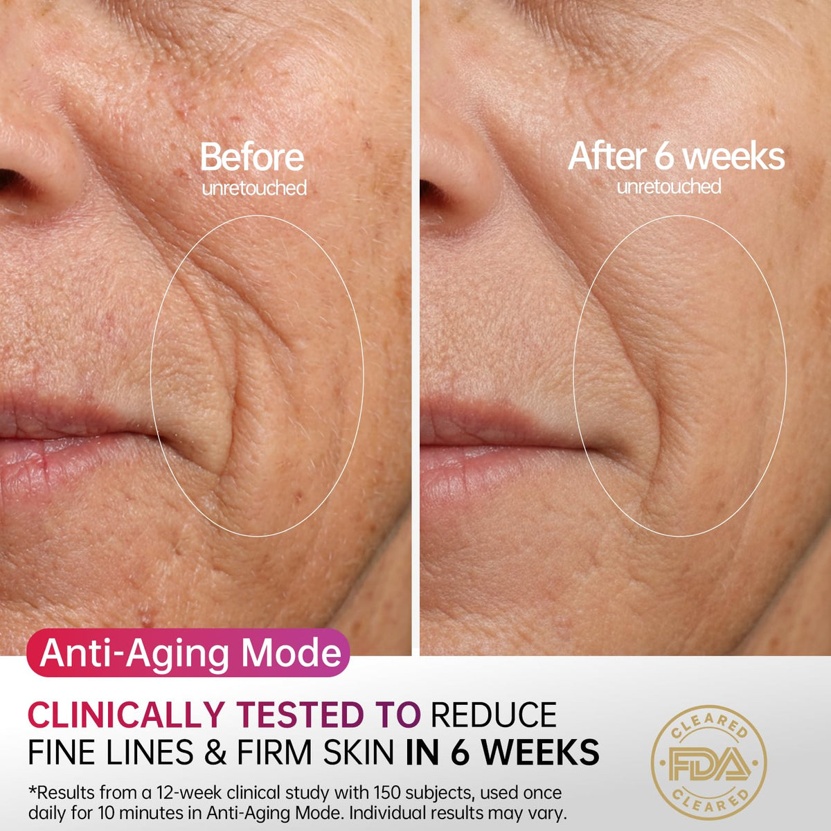 HOLYLOOK side profile on model showing secure fit across cheek and jawline for even results