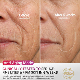 HOLYLOOK side profile on model showing secure fit across cheek and jawline for even results