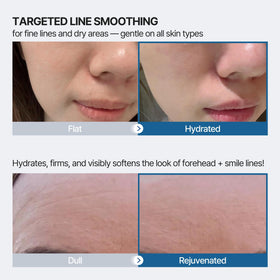 Honeydew Labs patch applied to forehead demonstrating comfortable overnight wear