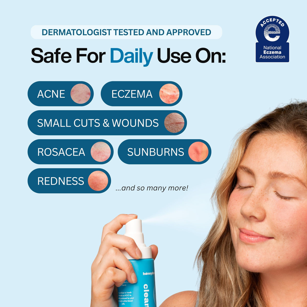 Honeydew Labs mist applied to cheek showing soothing effect on redness