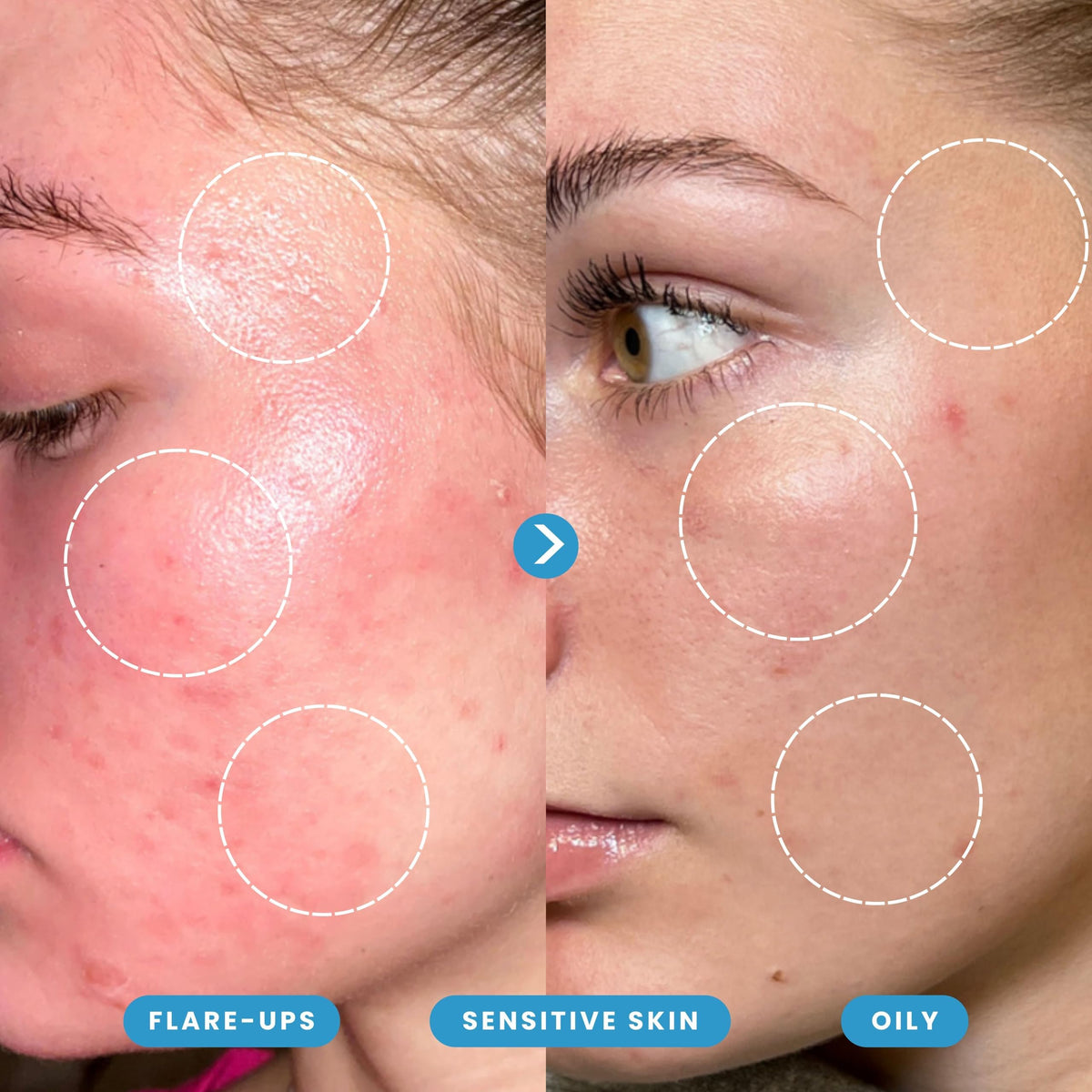 Honeydew Labs clear lightweight texture closeup showing non-greasy, fast-drying benefits