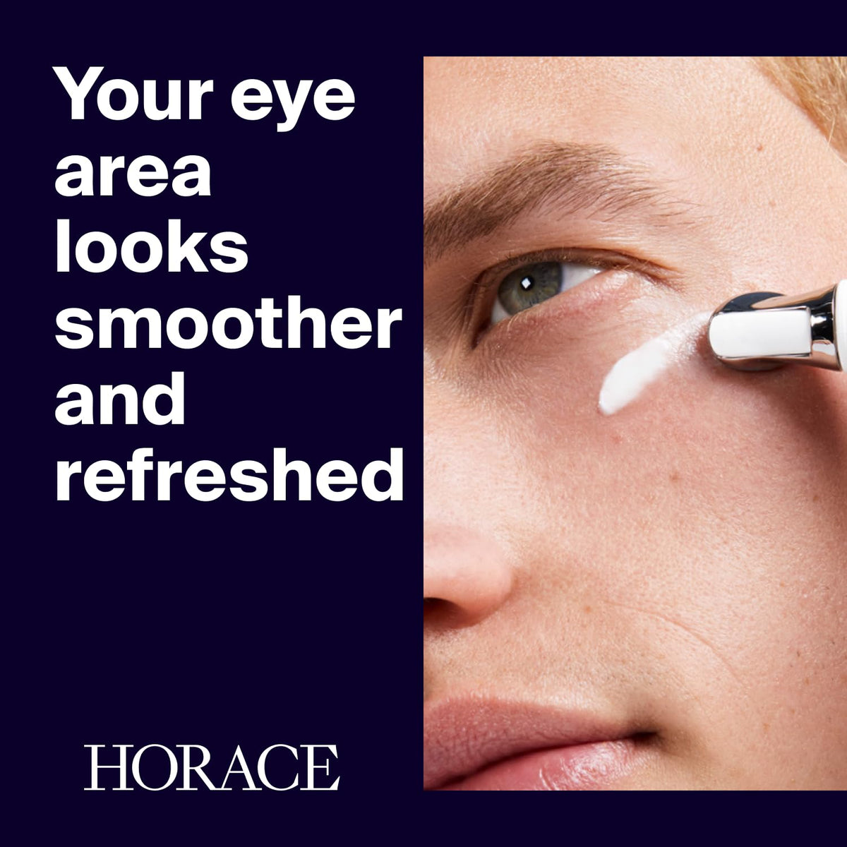 HORACE metal applicator close-up demonstrating cooling tip and precision