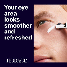 HORACE metal applicator close-up demonstrating cooling tip and precision