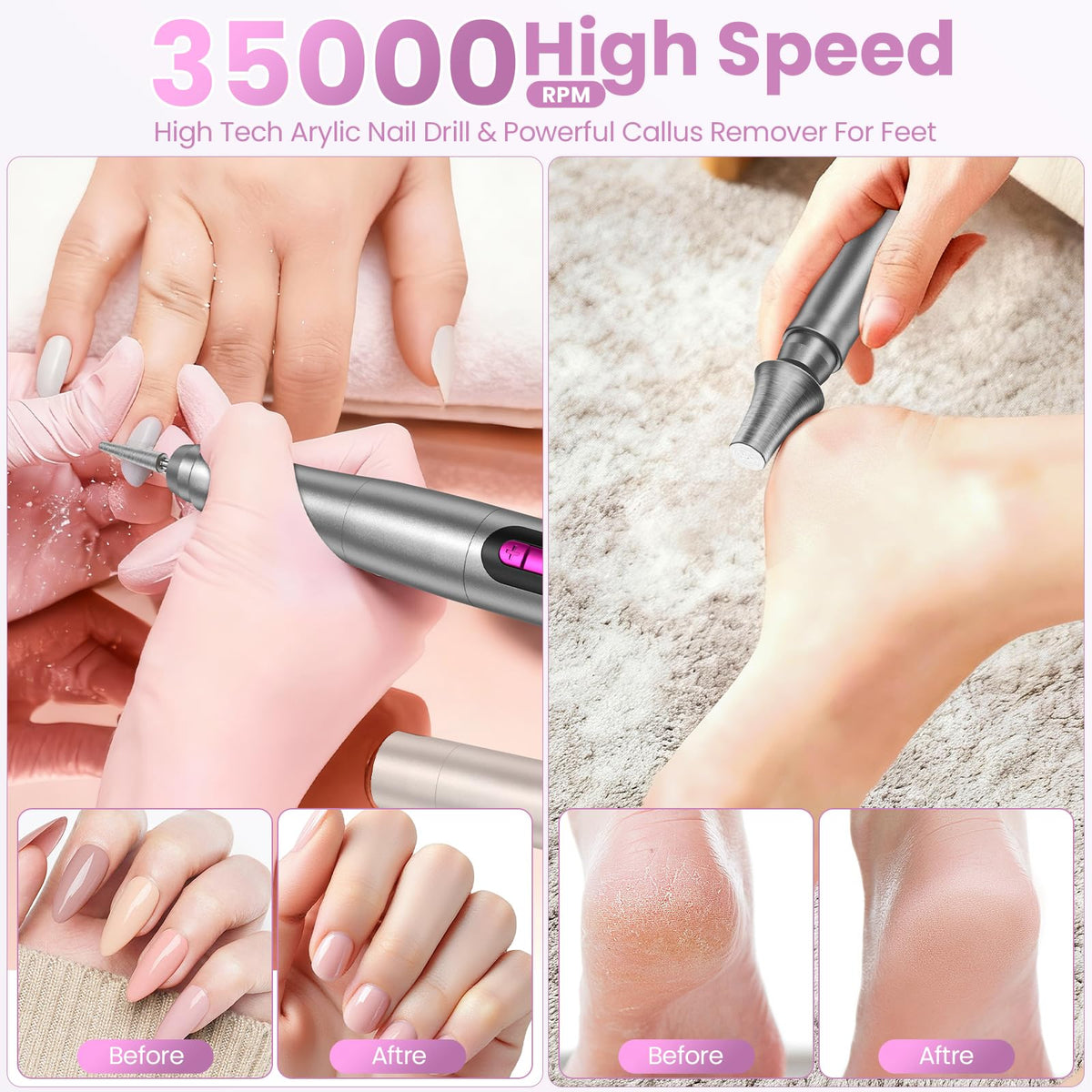 Hoxida kit arranged with bits and sanding bands for versatile nail tasks benefit