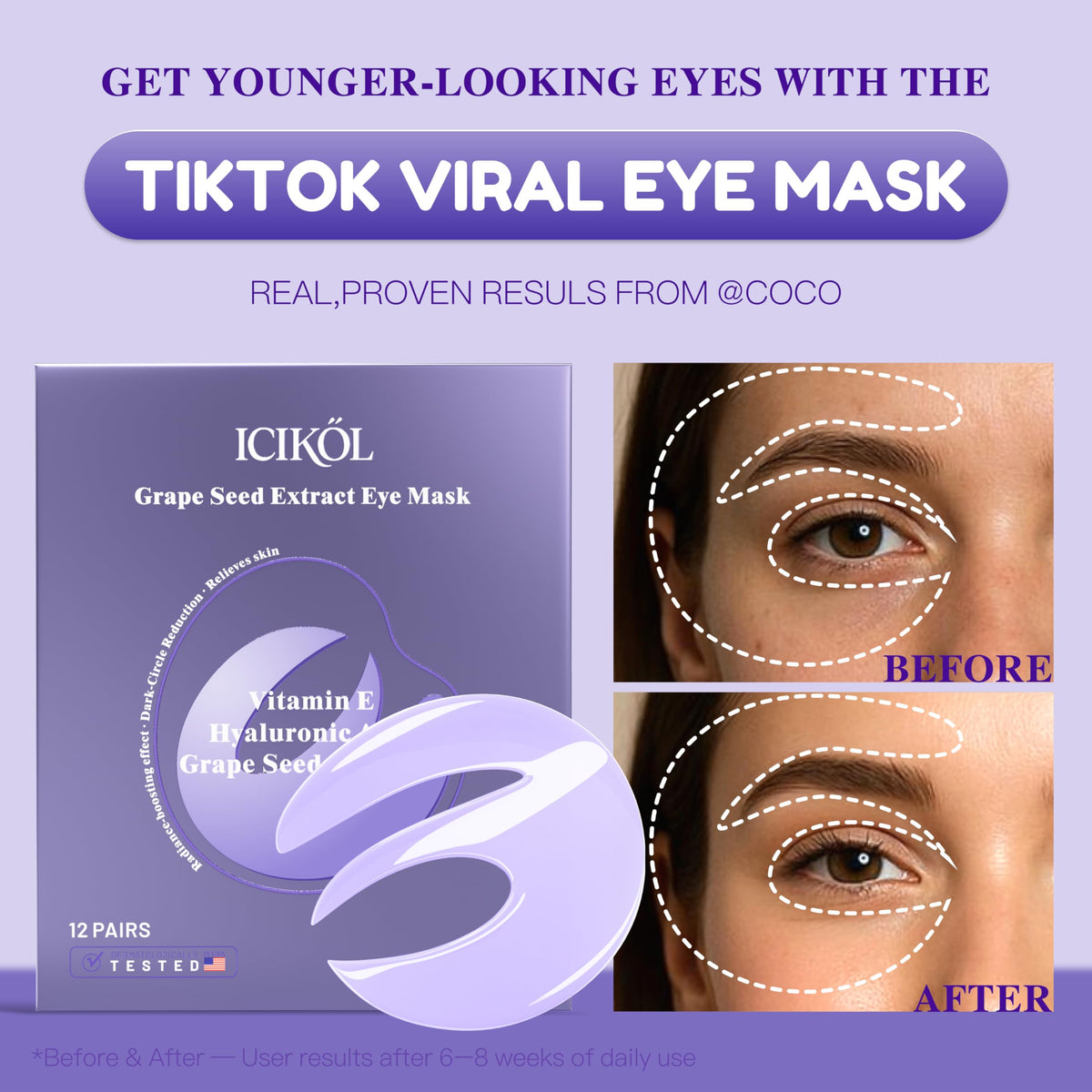 ICIKOL E-shaped patch applied under eye demonstrating full coverage benefit