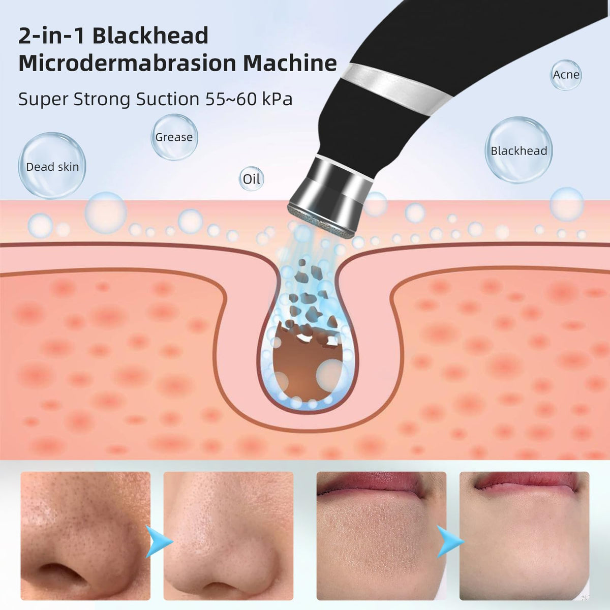 IeBilif array of four plastic and four diamond tips displayed to show versatility for different skin needs