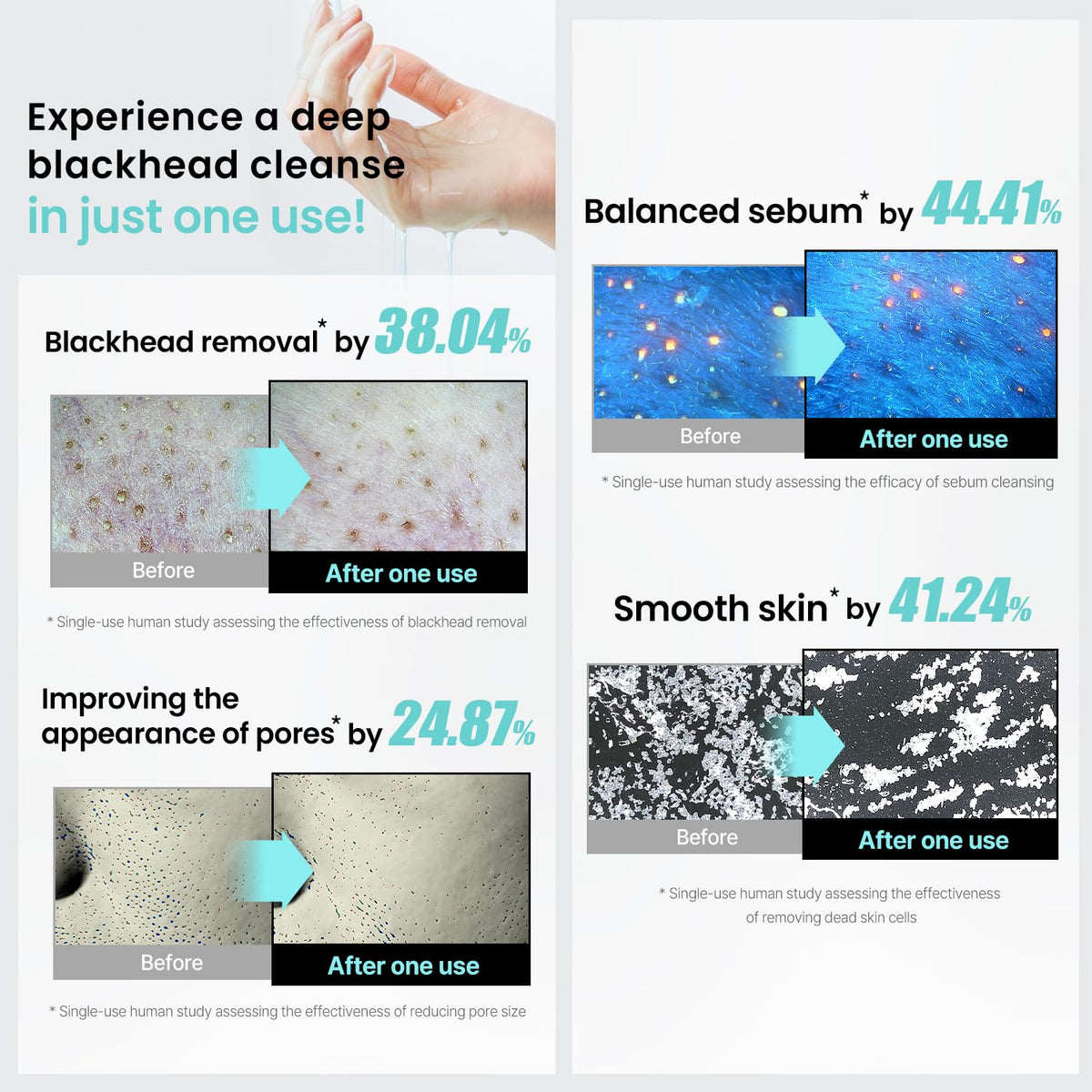 ilso ingredient label highlighting Centella Asiatica and pore-targeting complexes for soothing benefit