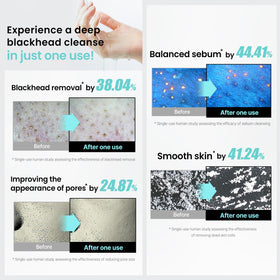 ilso ingredient label highlighting Centella Asiatica and pore-targeting complexes for soothing benefit