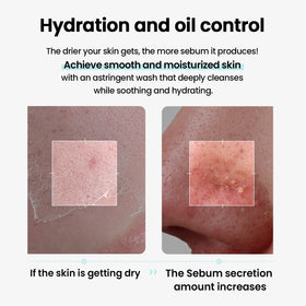 ilso watery oil texture drop on fingertip showing lightweight glide for gentle cleansing