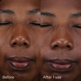 IMAGE Skincare before and after demonstrating evened skin tone and radiant look