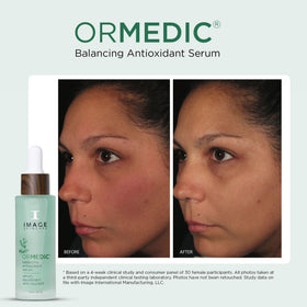 IMAGE Skincare ORMEDIC organic aloe vera gel beside bottle, conveys soothing hydration benefit