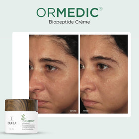 IMAGE Skincare ORMEDIC Biopeptide Crème opened jar revealing velvety cream for hydration