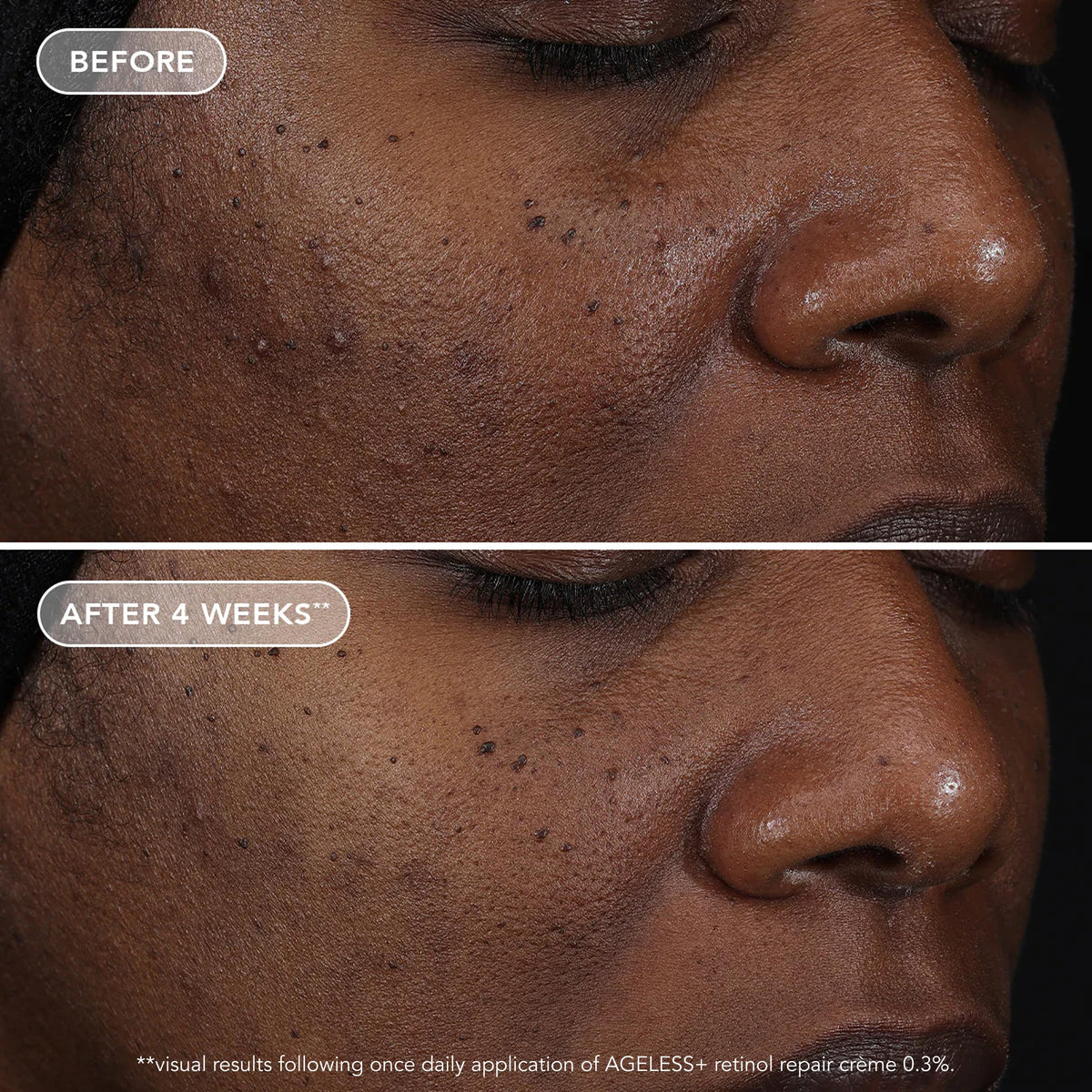 IMAGE Skincare conceptual before and after illustration showing improved skin texture