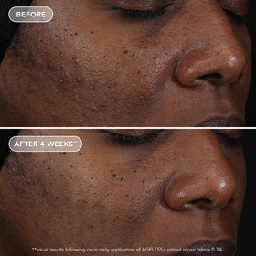 IMAGE Skincare conceptual before and after illustration showing improved skin texture