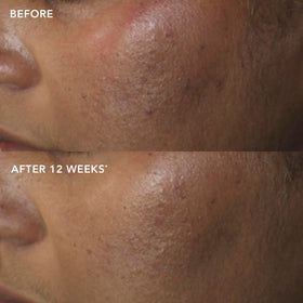 IMAGE Skincare serum applied during morning routine for antioxidant protection
