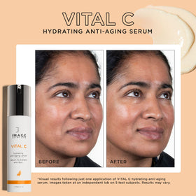 IMAGE Skincare VITAL C applied to face and neck for smoother look