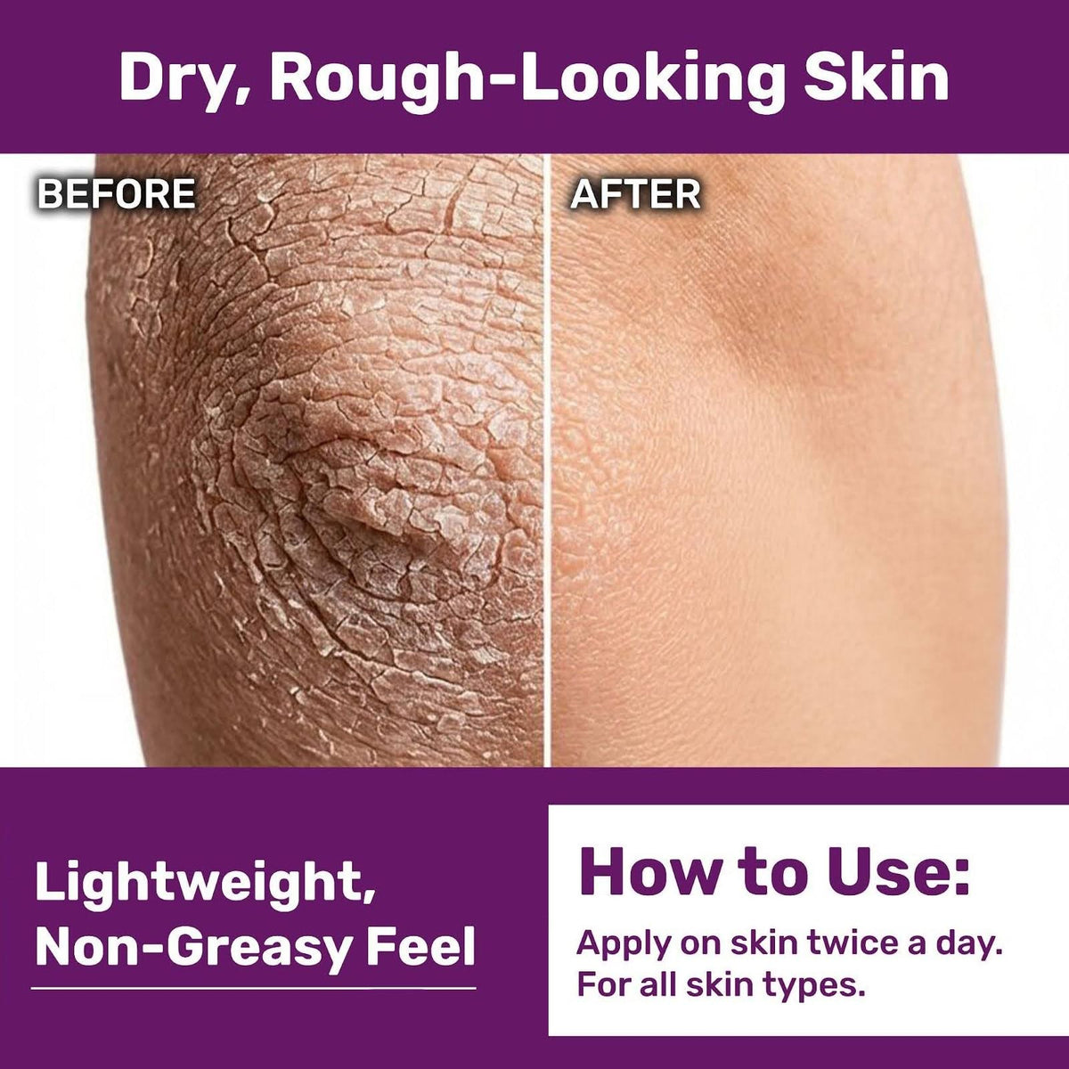 Immunocorp Immuderm open jar showing lightweight cream texture for quick absorption