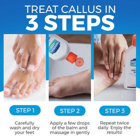 Imperial Feet applied to a heel demonstrating callus softening and soothing benefit