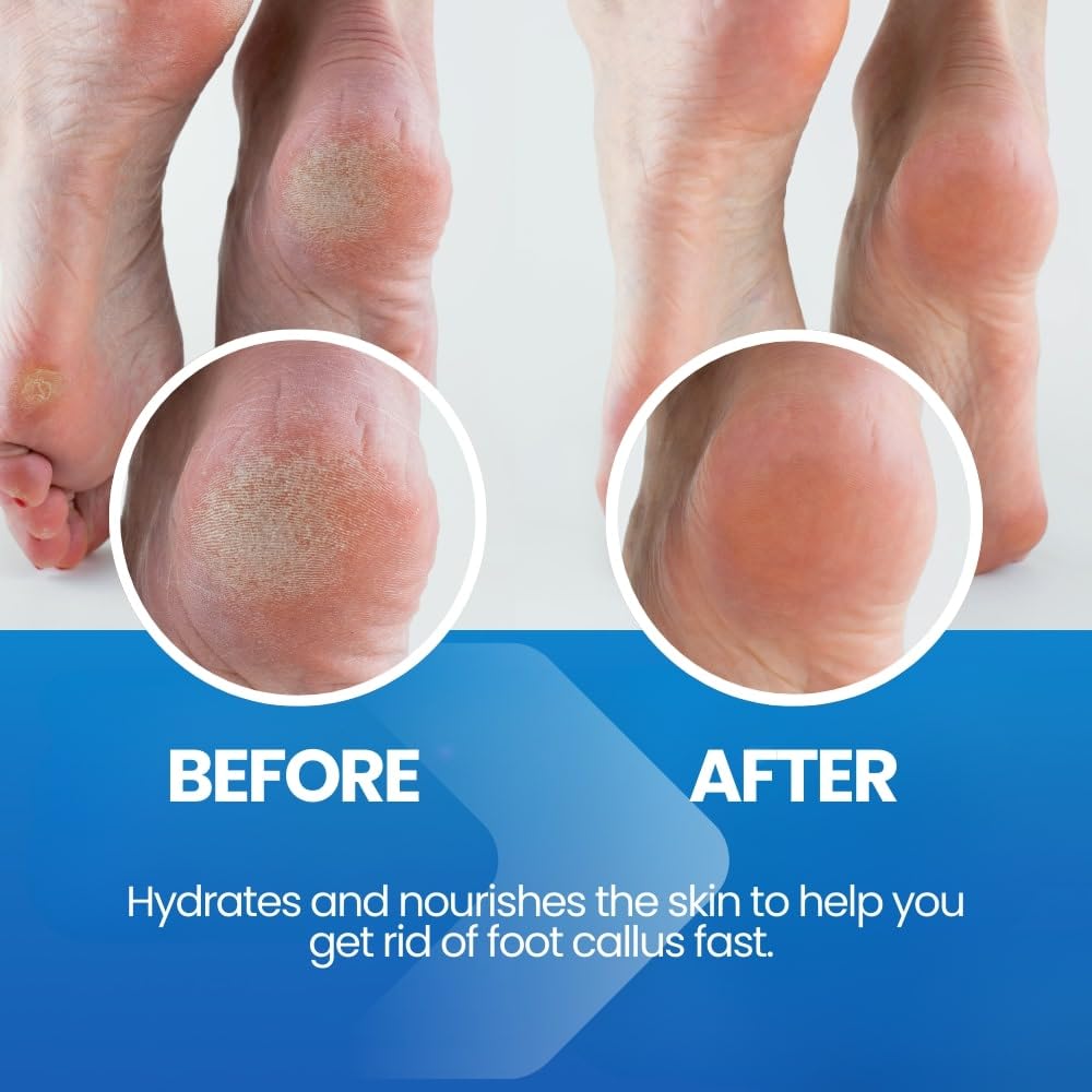 Imperial Feet spray nozzle close-up illustrating easy targeted application