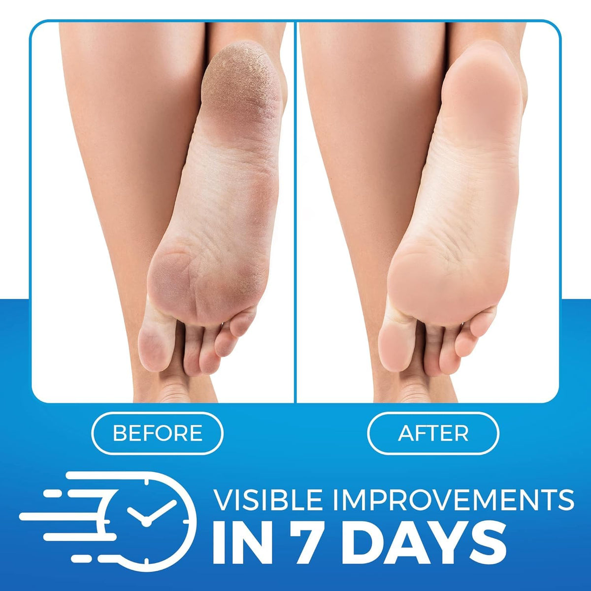 Imperial Feet cream texture close-up showing smooth non-greasy balm for fast absorption