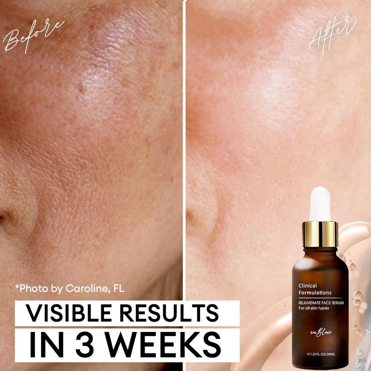 Inblair serum texture on fingertip highlighting lightweight feel and quick absorption benefit