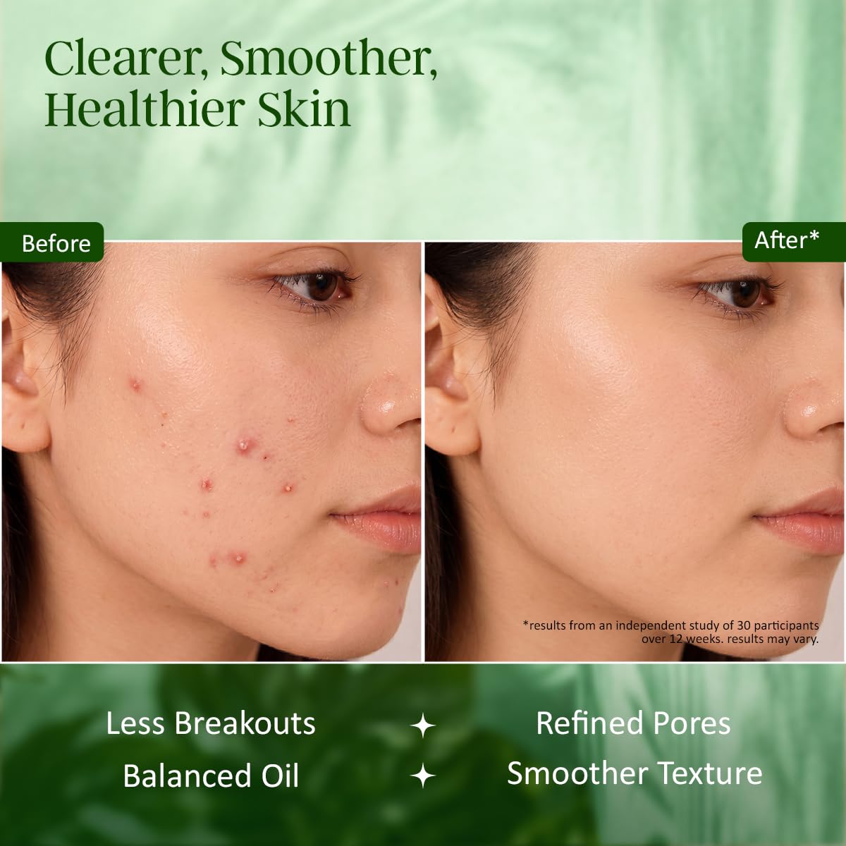 INDIAN SECRETS bar used on face demonstrating pore-targeted cleansing