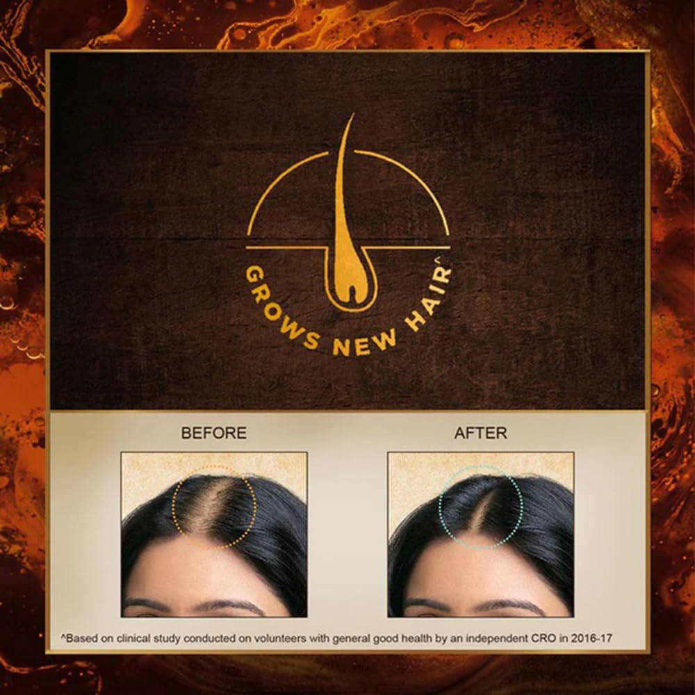 INDULEKHA applying oil to scalp with comb for targeted nourishment