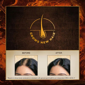 INDULEKHA applying oil to scalp with comb for targeted nourishment