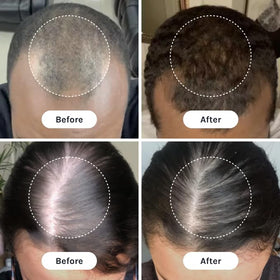 Applying InfiniWell serum to scalp for focused follicle support