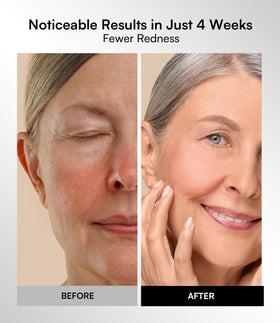 INIA mask in use during a relaxation routine illustrating at-home professional feel