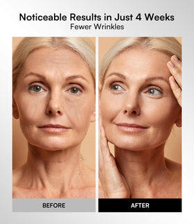 INIA mask on model relaxing demonstrating hands-free home treatment