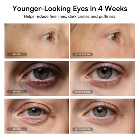 INIA mask worn in use demonstrating how it reduces visible puffiness