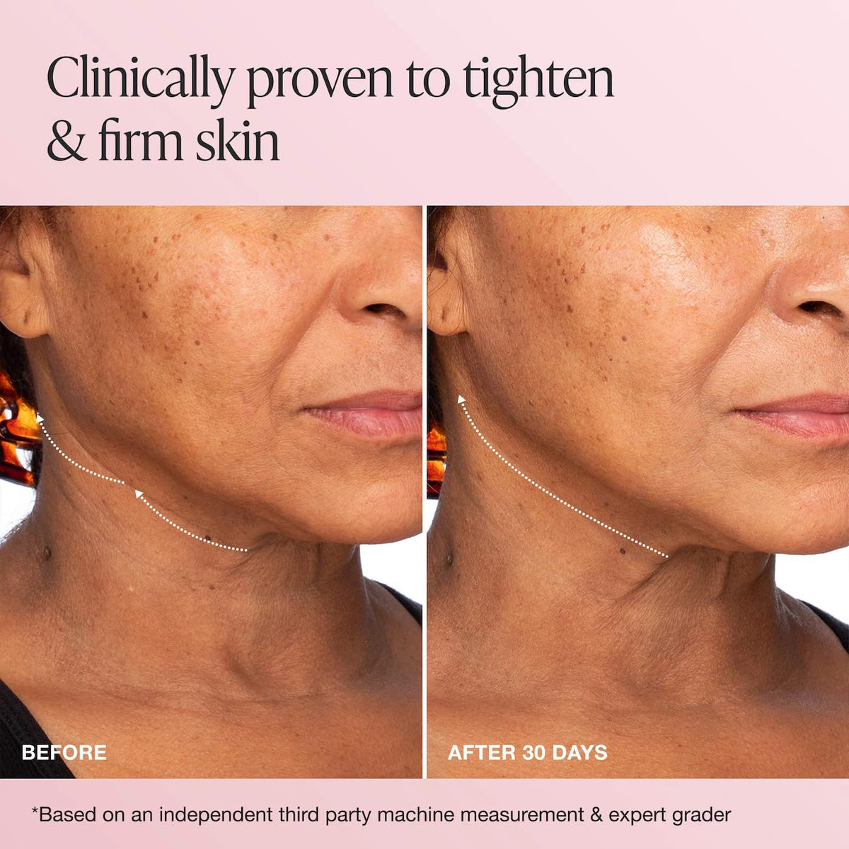 Innbeauty Project key ingredient extracts displayed to highlight firming support benefits