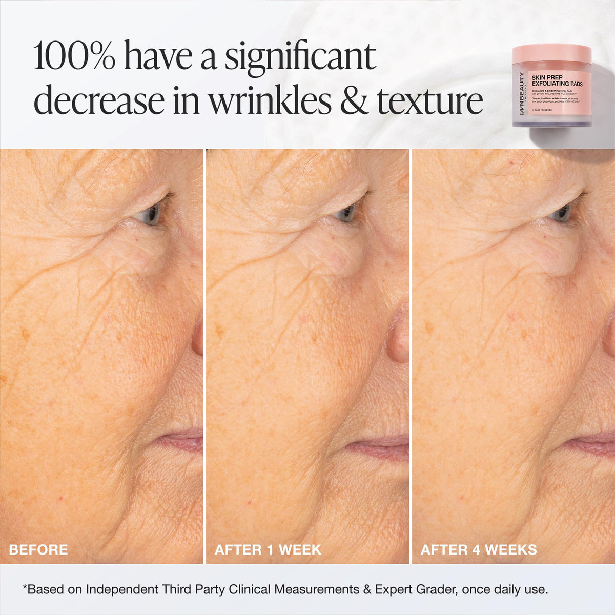Innbeauty Project ingredient label close-up listing glycolic and mandelic acids