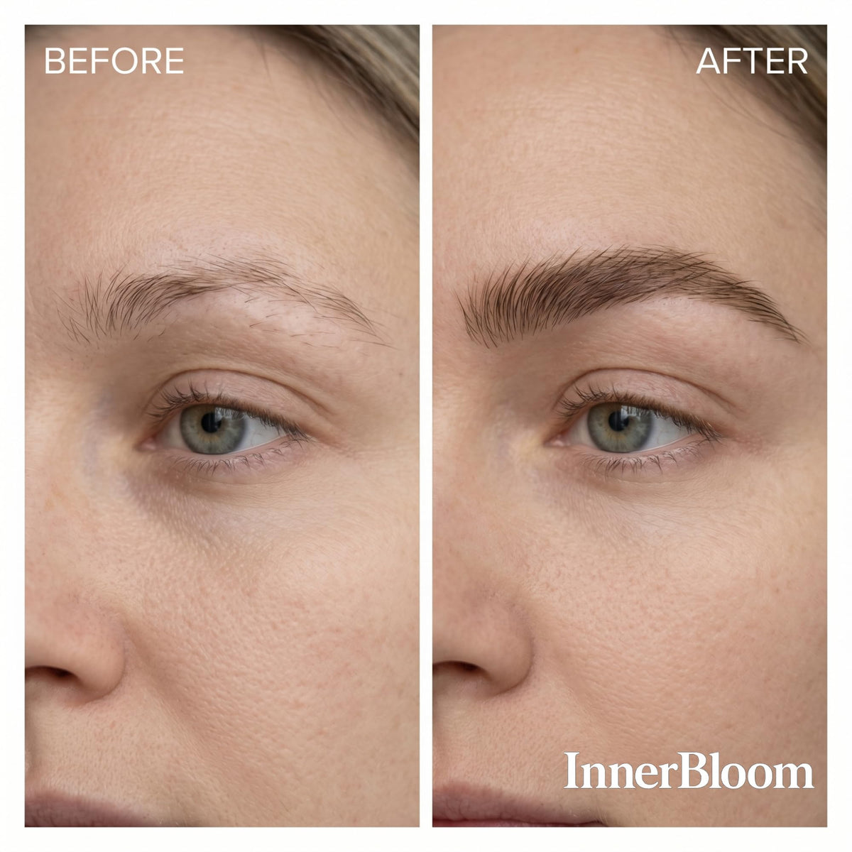 Innerbloom ingredient label detail highlighting 2% minoxidil and NanoCalm benefits