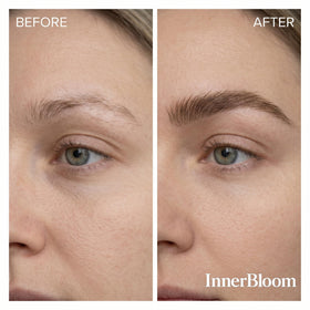 Innerbloom ingredient label detail highlighting 2% minoxidil and NanoCalm benefits